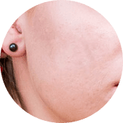 _Section - 089 Pain Img #1