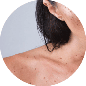 _Section - 089 Pain Img #5